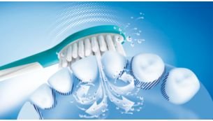 Pažangi „Philips Sonicare“ technologija „sonic“