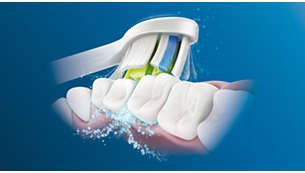 Pažangi „Philips Sonicare“ technologija „sonic“